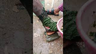 Elephantiasis Treatment [upl. by Ariuqahs]