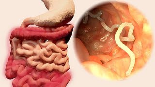 Nematode Navigations A Dive into Gastrointestinal Parasites 4 Minutes [upl. by Legnaleugim]