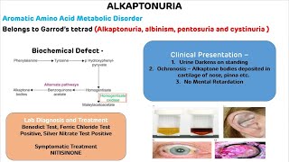 Alkaptonuria Quick Revision  NEET PG 2021 [upl. by Madson541]