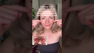 Eliminate under eyes puffiness facemassage faceyoga short [upl. by Bathulda]