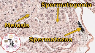 Insect Grasshopper Testes  Histology and Anatomy [upl. by Adivad]