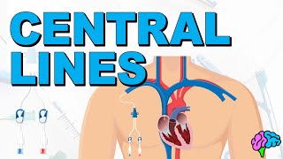 The Basics of Central Lines  Central Venous Catheters CVC [upl. by Savadove]