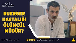 Buerger Hastalığı Ölümcül müdür  Buerger Hastalığı Tedavisi var mı [upl. by Siuraj231]