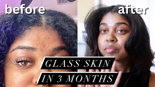 my simple skincare routine  korean skincare for black skin [upl. by Samoht]