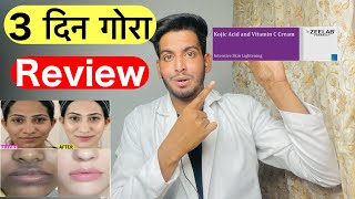 Kojic acid and vitamin c cream Kojic acid and vitamin c cream reviewगोरा करने वाली क्रीम 3 दिन में [upl. by Scevor]