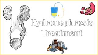 Hydronephrosis Treatment  Medical amp Surgical Management Of Hydronephrosis [upl. by Bertina]