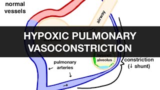 Hypoxic Pulmonary Vasoconstriction HPV [upl. by Peterus969]