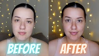 TANLUXE FACE TANNING DROPS REVIEW AND FIRST IMPRESSIONS  HOUR BY HOUR WEART TEST [upl. by Eirrac]