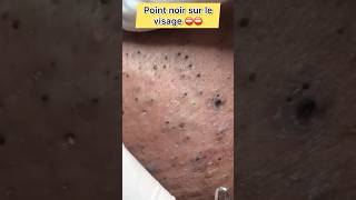 ⚠️‼️Point noir sur le visage⛔️pointnoir fyp shorts short shortvideo shortsvideo viral [upl. by Alleirbag]