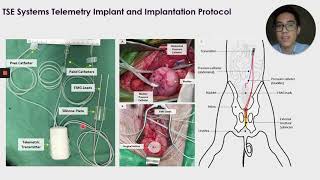 116 Urodynamic Studies and Telemetric Monitoring of Bladder Function After Traumatic Thoracic S [upl. by Naujit]