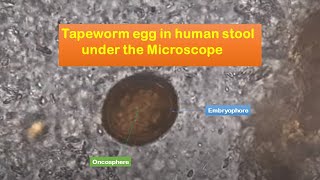 Tapeworm eggs in human stool under the Microscope [upl. by Oirobil]