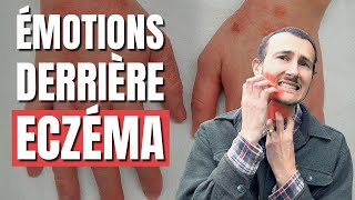 La Cause PsychoÉmotionnelle de lEczéma [upl. by Heins]