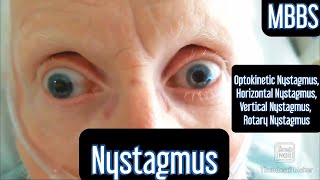 Nystagmus Optokinetic Horizontal Vertical Rotary mbbs medicine neetpg usmle [upl. by Adnoved]