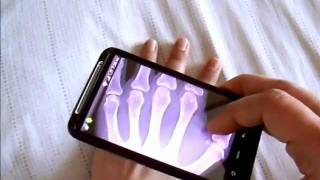 XRay Scanner Pro free app for Android [upl. by Korfonta]