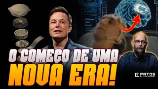 Urgente Elon Musk implanta chip no cérebro do primeiro humano [upl. by Gayner]