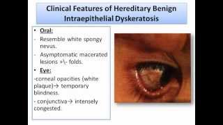 Developmental Disturbances of Soft Tissues Part2Oral Pathologywmv [upl. by Einatirb]