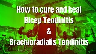 Bicep tendonitis amp brachioradialisforearm tendinitis [upl. by Annotahs]