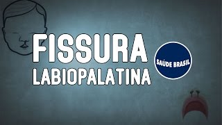 FISSURA LABIOPALATINA  SÉRIE SAÚDE BRASIL [upl. by Yelsehc]