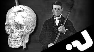 🪐Lincroyable histoire de Phineas Gage [upl. by Losyram747]