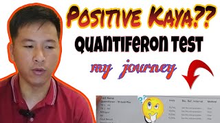 🔴 Positive kaya Quantiferon Test Kinabahan ako [upl. by Sebastien]