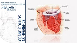 Mitral Valve Regurgitation Evolving Concepts in Diagnosis Prognosis amp Mgmt Zoghbi MD 091219 [upl. by Belvia114]