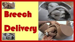 Breech Delivery  Mechanism of Labour in Breech Presentation [upl. by Lledyl]