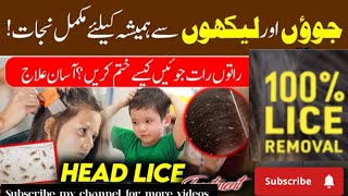 Anti lice solution naturally 💯☝️ anti lice treatment  جوئوں کو ختم کرنے کا آسان طریقہ 🔥 [upl. by Gildea635]