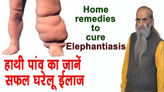 गुरुजी से जाने हाथी पांव की समस्या को कैसे दूर करें  Home Remedies to cure elephantiasis [upl. by Saree105]