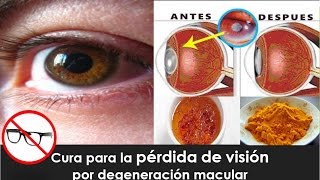 Cura para la pérdida de visión por degeneración macular [upl. by Bartlet354]