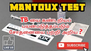 MANTOUX TEST  USES  METHOD  PROCEDURE  PHARMA TAMIL  AKI 46 [upl. by Atiuqes]