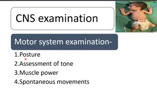 CNS Examination in Newborn  Newborn Examination Part9  Pediatrics [upl. by Drugi]