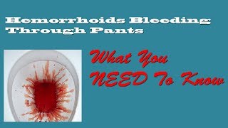 Hemorrhoid Bleeding Through Pants [upl. by Slayton789]