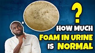 How Much Foam In A Urine Is Normal Urine Problems [upl. by Enneyehs77]