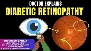 Factors which Increase Diabetic Retinopathy eyes eye clinic delhi newdelhi lasik diabetes [upl. by Abbi]