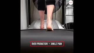 Addressing Overpronation and Ankle Pain How Orthotic Insoles like Ergonx amp Docpods Can Help 👣💡 [upl. by Epner813]