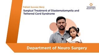 Surgical Treatment of Diastematomyelia and Tethered Cord Syndrome  Yashoda Hospitals Hyderabad [upl. by Lleret]