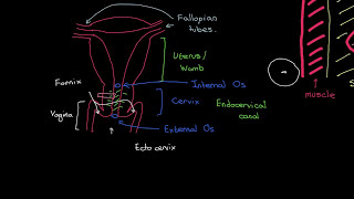 Squamous Intraepithelial lesion amp CANCER CERVIX [upl. by Sama]