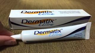 Effect of Dermatix Ultra After my DST eyelid surgery [upl. by Jacoba]