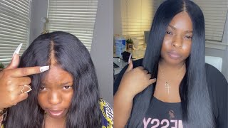 How to  Fix Balding Lace Closure  Wig Maintenance [upl. by Barnett]