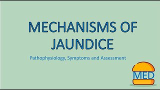 JAUNDICE MADE EASY  Mechanism Pathophysiology and Assessment [upl. by Vander]