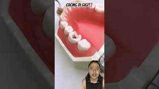 CACING DI GIGI⁉️ dentist teethshield diy healthyteeth satisfying handmade art music anime [upl. by Lekym]