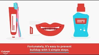 How to Remove and Prevent Plaque on Teeth  Colgate® [upl. by Ettelliw451]