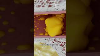 How to Remove Ear Wax Blockage the Right Way shorts facts  creativelearning3d [upl. by Beutner872]