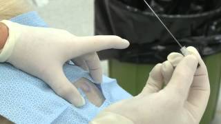 Performing an Epidural in a Dog for for Pain Control [upl. by Inalaeham]