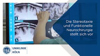 Die Stereotaxie und Funktionelle Neurochirurgie stellt sich vor  Uniklinik Köln [upl. by Esdras591]