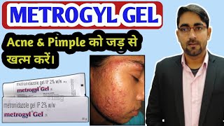 Metrogyl Gel for Acne के बारे में पूरी जानकारी। Metrogyl gel Review  Metrogyl gel Uses in Hindi [upl. by Hortensia]