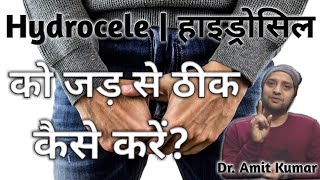 Hydrocele  हाइड्रोसील का इलाज।कैसे इसे जड़ से ठीक करें। Treatment of Hydrocele [upl. by Ellynad]