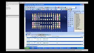 Dentrix training 6 Patient Chart [upl. by Arrak946]