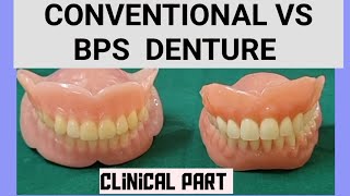 BPS DENTURE clinical procedure part [upl. by Arick]