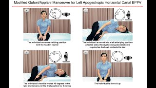 Modified GufoniAppiani Manoeuvre for Left Apogeotropic Horizontal Canal BPPV [upl. by Ahseirej]